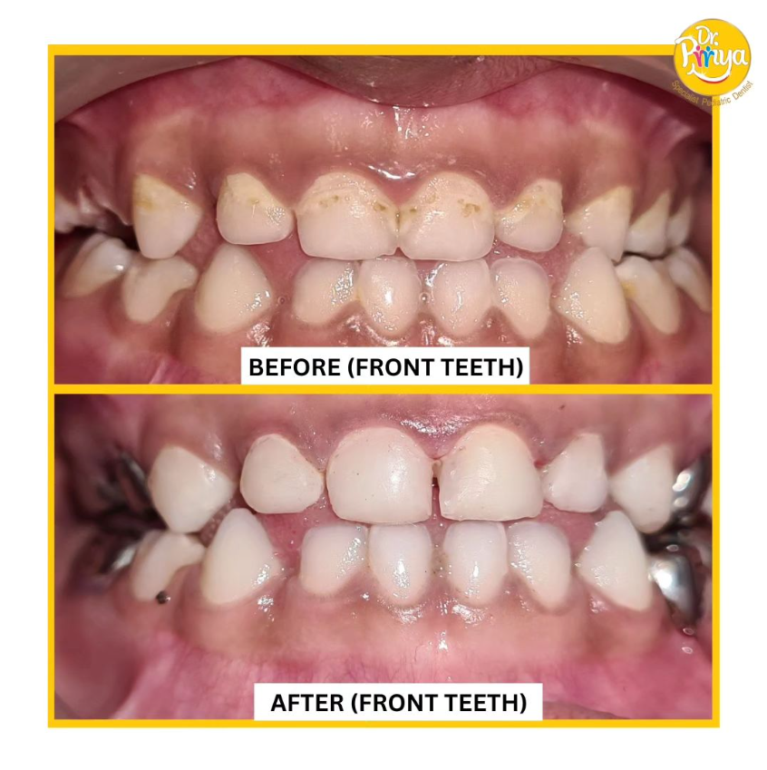 pediatric dentist in dubai